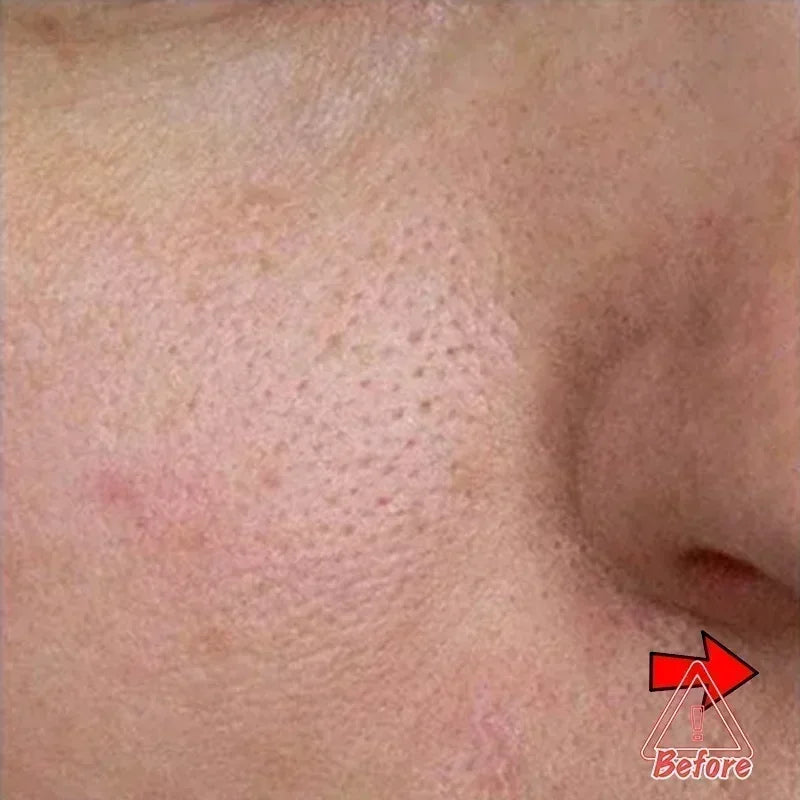 Pore Perfecting Serum